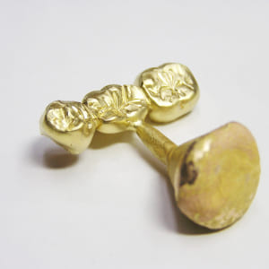 金歯・歯科板金の画像